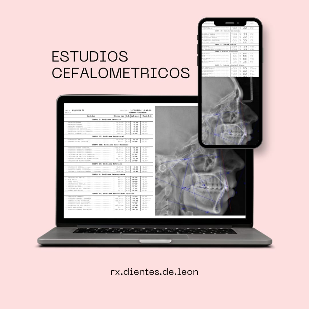 Estudios Cefalométricos Computarizados