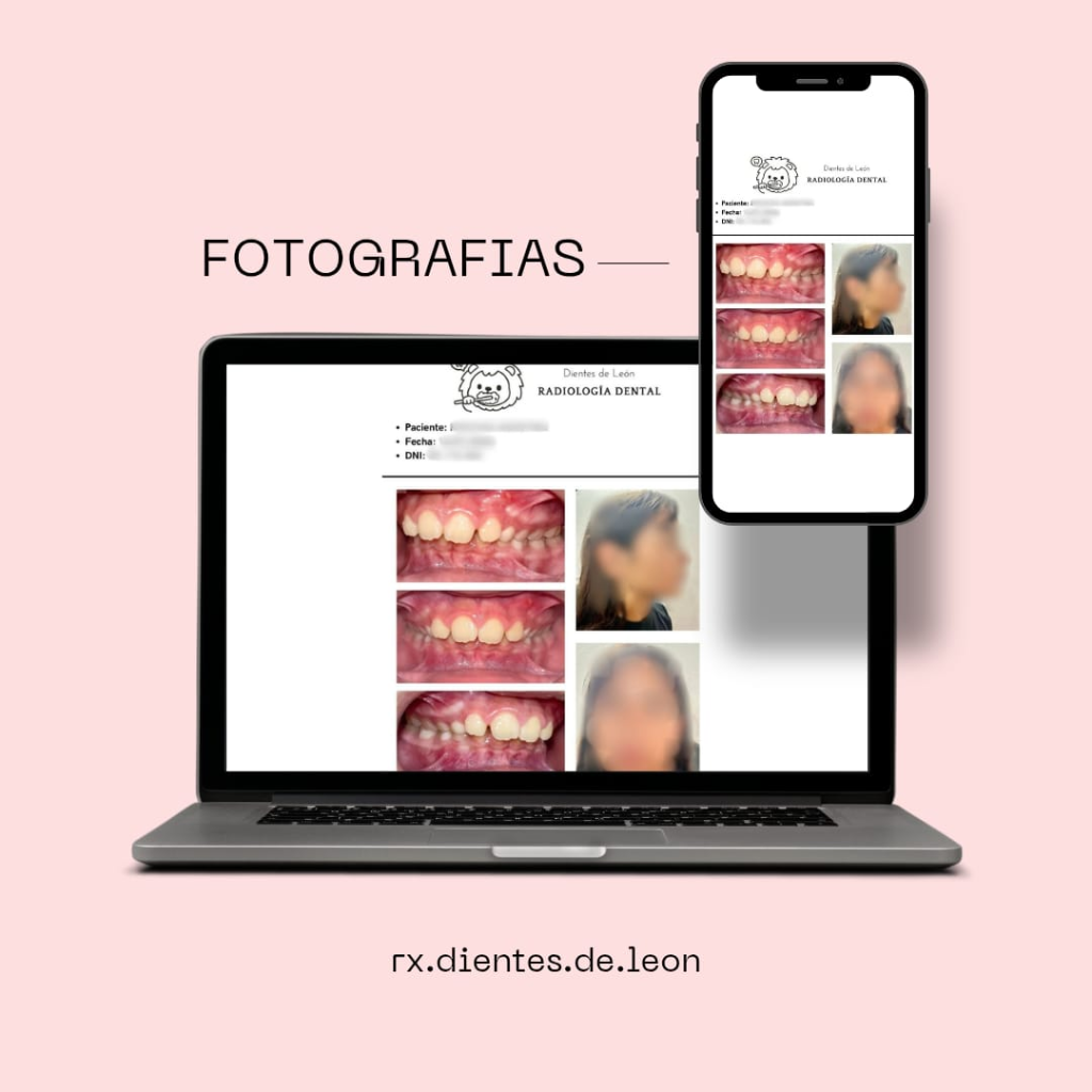 Fotografías Clínicas Dentales