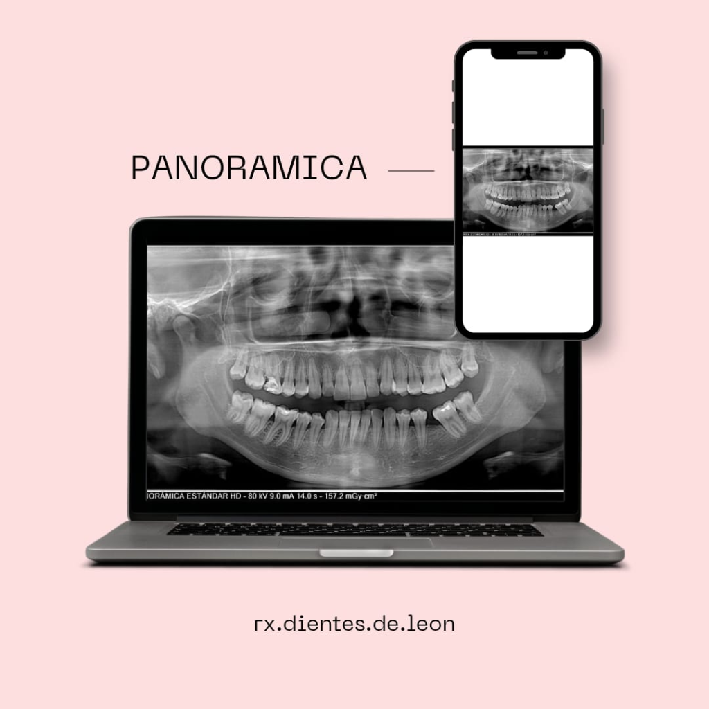 Radiografía Panorámica Digital