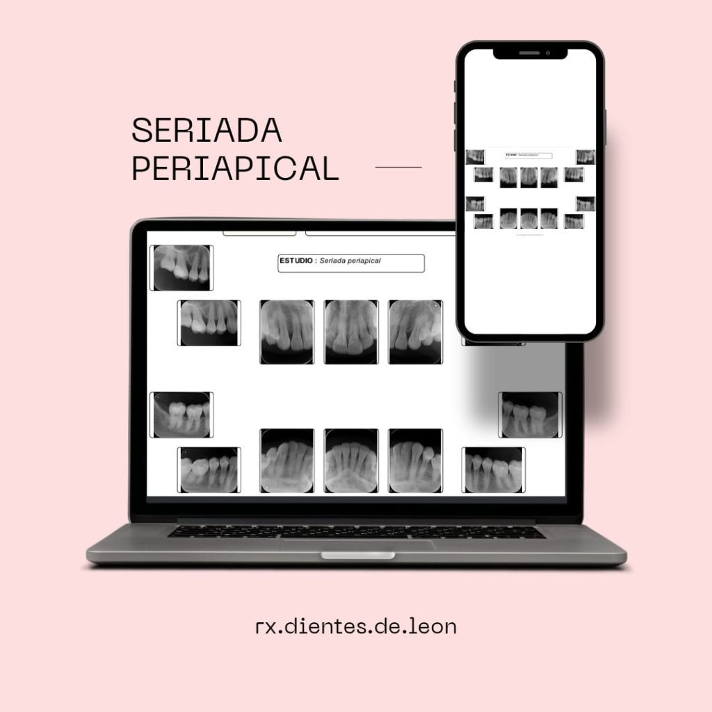 Seriada Periapical Completa