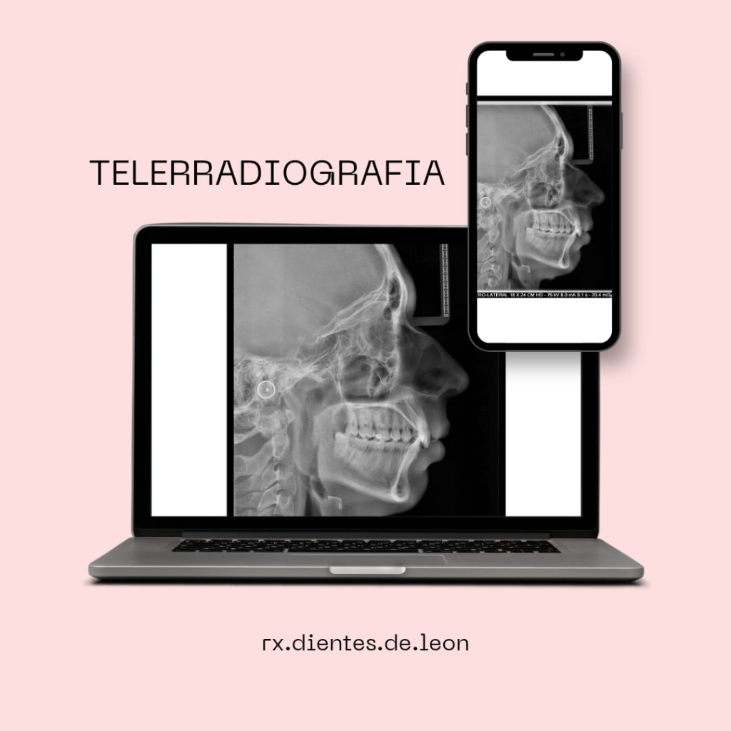 Telerradiografía Lateral de Cráneo