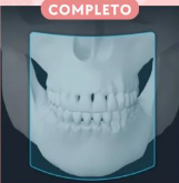 Ambos maxilares completos