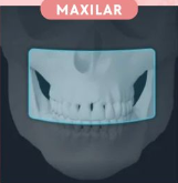 Maxilar superior o mandíbula